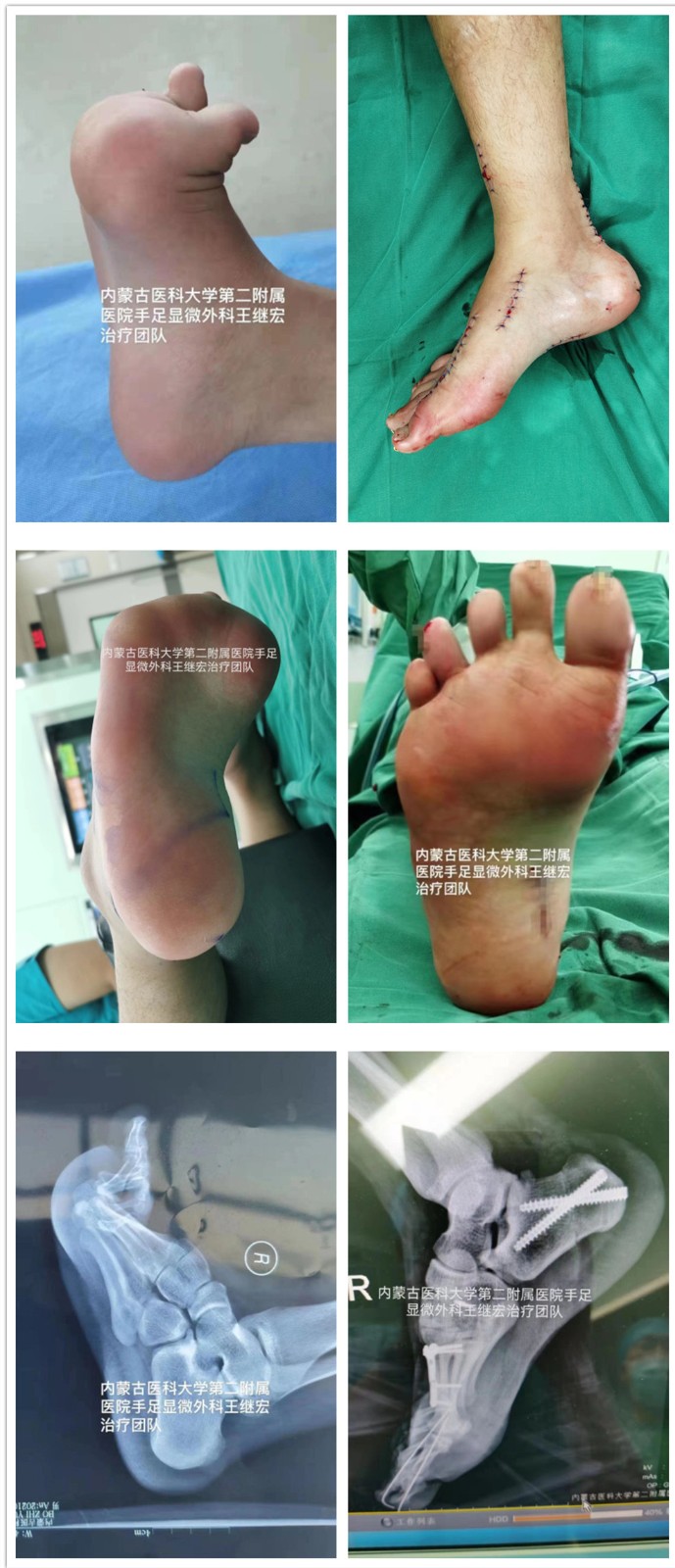 1649759902661044425.jpg 微信图片_20220411112358_编辑.jpg