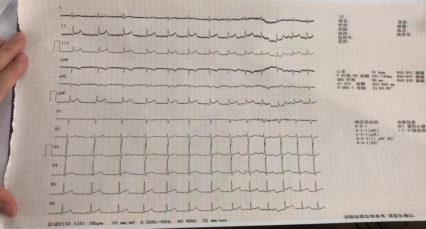 1660785238685068098.png 1660785238685068098.png