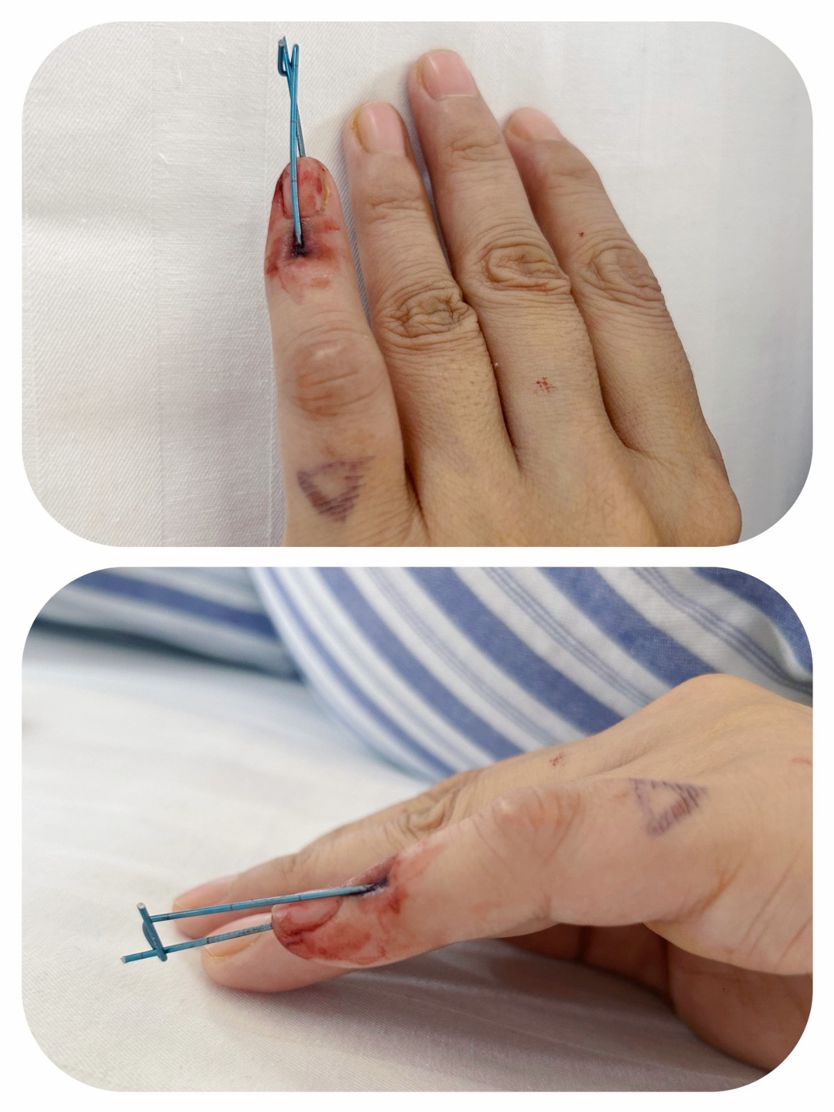 1775206539547067495.jpg 1775206539547067495.jpg